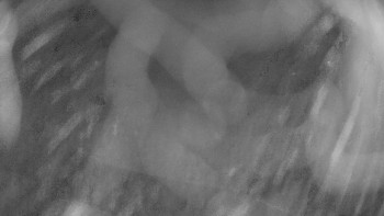 Zámecké koupaliště Holešov