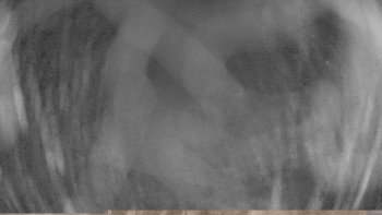 Zámecké koupaliště Holešov