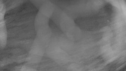 Areál koupaliště Holešov