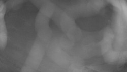 Areál koupaliště Holešov