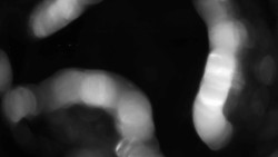 Areál koupaliště Holešov