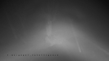 Horský hotel Čarták na Soláni