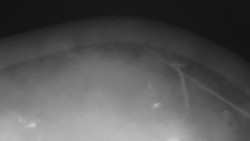 Lanovka - pohled nahoru