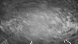 Lanovka - pohled dolů