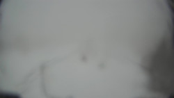 Lanovka - pohled dolů