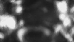 Lanovka - pohled dolů