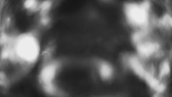 Lanovka - pohled dolů