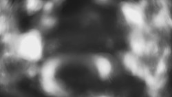 Lanovka - pohled dolů