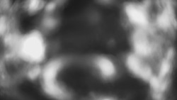 Lanovka - pohled dolů