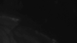 Přístup na běžeckou trať