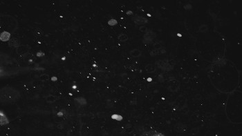 Ski areál U Sachovy studánky