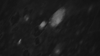 Ski areál U Sachovy studánky