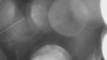 SKICENTRUM Miroslav Lipová Lázně