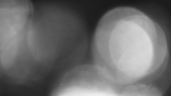 SKICENTRUM Miroslav Lipová Lázně