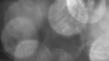 SKICENTRUM Miroslav Lipová Lázně