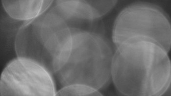 SKICENTRUM Miroslav Lipová Lázně