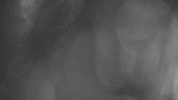 SKICENTRUM Miroslav Lipová Lázně