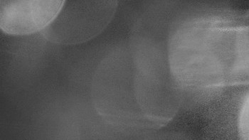 SKICENTRUM Miroslav Lipová Lázně