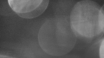 SKICENTRUM Miroslav Lipová Lázně