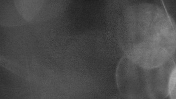 SKICENTRUM Miroslav Lipová Lázně