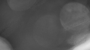 SKICENTRUM Miroslav Lipová Lázně