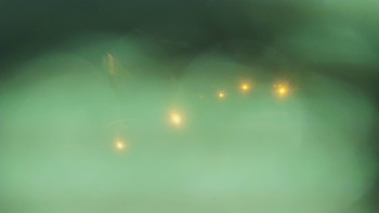 SKICENTRUM Miroslav Lipová Lázně