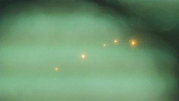 SKICENTRUM Miroslav Lipová Lázně