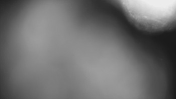 SKICENTRUM Miroslav Lipová Lázně