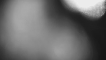 SKICENTRUM Miroslav Lipová Lázně