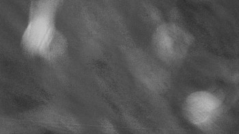 SKICENTRUM Miroslav Lipová Lázně