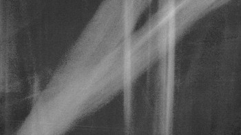 SKICENTRUM Miroslav Lipová Lázně