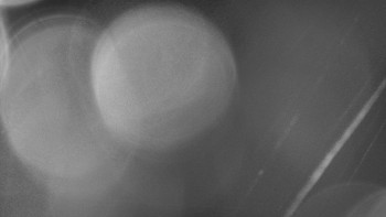 SKICENTRUM Miroslav Lipová Lázně