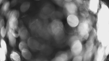 SKICENTRUM Miroslav Lipová Lázně