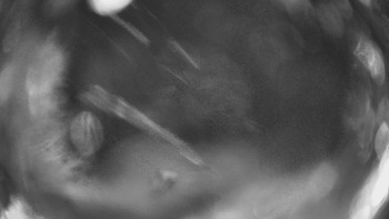 SKICENTRUM Miroslav Lipová Lázně