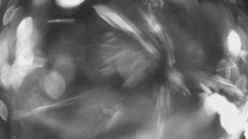 SKICENTRUM Miroslav Lipová Lázně