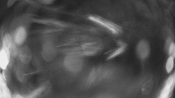 SKICENTRUM Miroslav Lipová Lázně