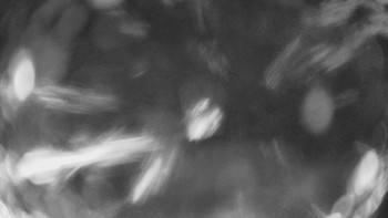 SKICENTRUM Miroslav Lipová Lázně