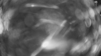 SKICENTRUM Miroslav Lipová Lázně