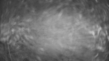 SKICENTRUM Miroslav Lipová Lázně