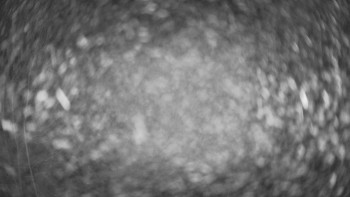 SKICENTRUM Miroslav Lipová Lázně