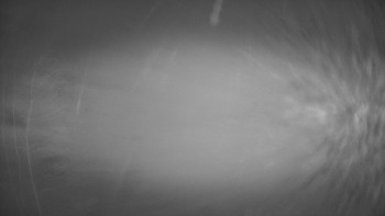 SKICENTRUM Miroslav Lipová Lázně