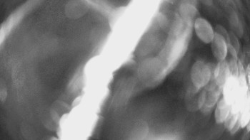 SKICENTRUM Miroslav Lipová Lázně