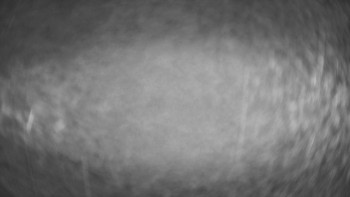 SKICENTRUM Miroslav Lipová Lázně