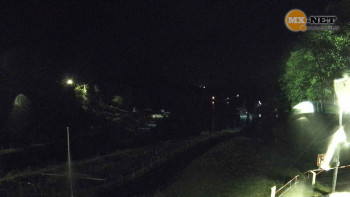 Slezská Harta
