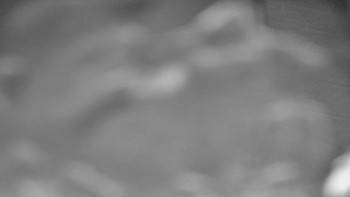 Ski areál SEVERKA v Dolní Lomné