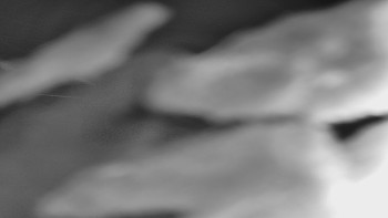 Ski areál SEVERKA v Dolní Lomné