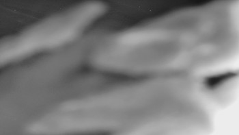 Ski areál SEVERKA v Dolní Lomné