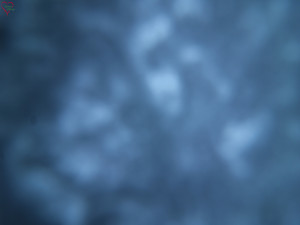 Rozhledna Poledník - Rozhledna Poledník - 31.3.2026 v 06:45 Rozhledna Poledník - Rozhledna Poledník - 31.3.2026 v 06:45