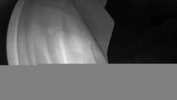 Lyžařský vlek Karlova Studánka