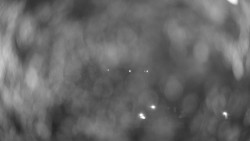 Hospitál